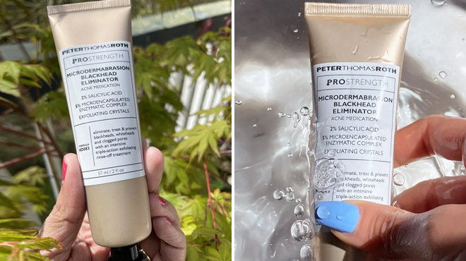 Two Images of Peter Thomas Roth PRO Strength Microdermabrasion Blackhead Eliminator