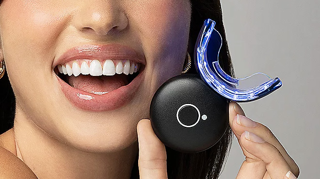 LED Teeth Whitening Device Kit 1