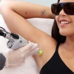 A Person getting a Laser Hair Removal Session for Underarms