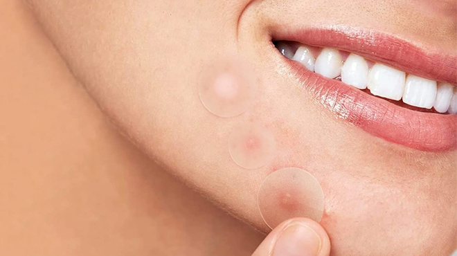 Person Using Pimple Patches